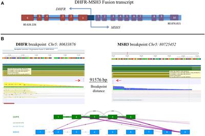 Single-nucleotide polymorphism profiling by multimodal-targeted next-generation sequencing in methotrexate-resistant and -sensitive human osteosarcoma cell lines